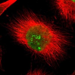 POLR2F Antibody, Novus Biologicals 0.1mL; Unlabeled:Antibodies, Polyclonal